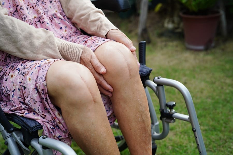 patient after knee surgery in a wheelchair