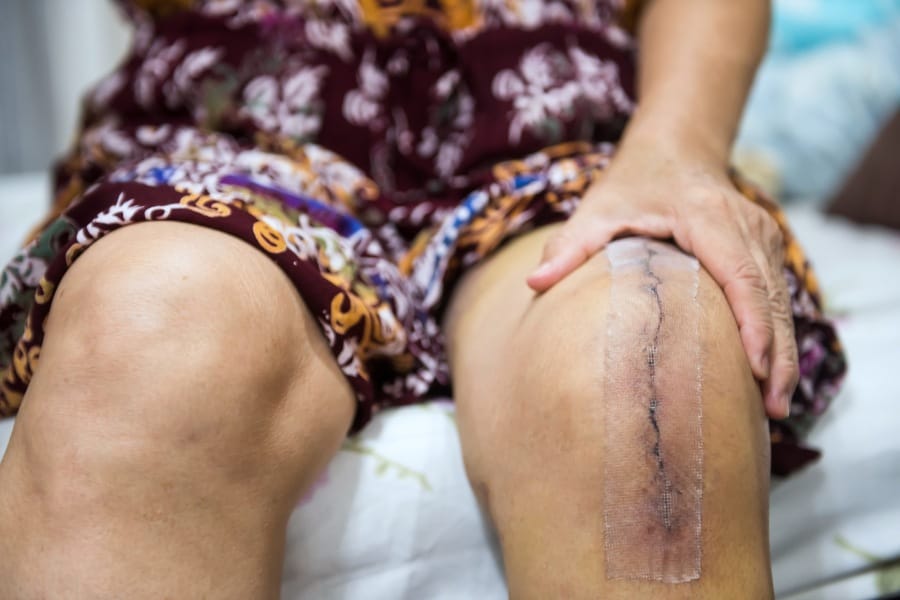 elderly woman after knee surgery