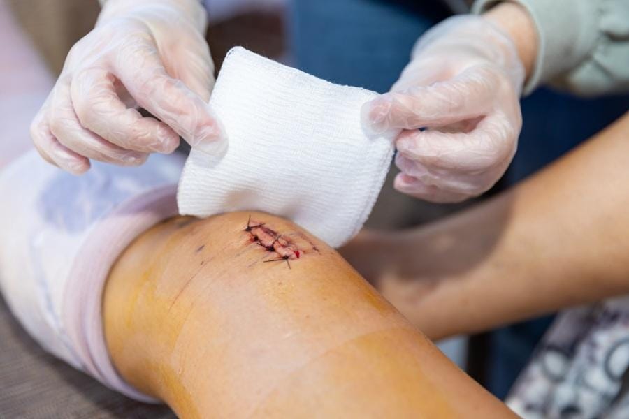 A client with a wound on their knee receiving medical care at home